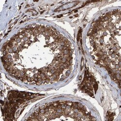 FAM117A Antibody, Novus Biologicals:Antibodies:Primary Antibodies